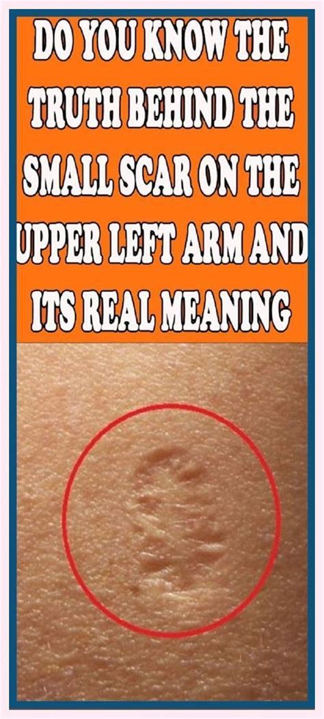 do you know the truth behind the small scar on the upper left arm and its real meaning