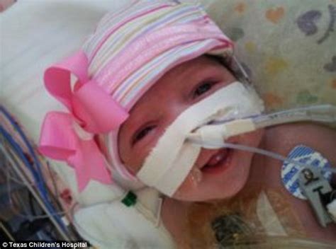 Miracle Baby Born With Heart That Beats Outside Her Body Now Recovering