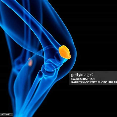 Human Knee Cap Photos And Premium High Res Pictures Getty Images