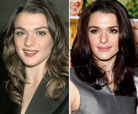 It seems the actress went through the procedure of lip fillers for her enhancement. Celebrities: By the nose, Rachel Weisz | Cosmetic surgery ...