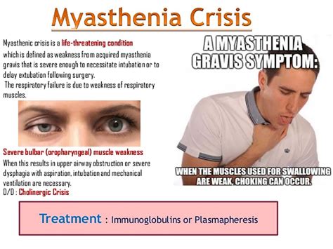 Myasthenia gravis (mg) is an autoimmune disorder of the postsynaptic neuromuscular junction characterized by fluctuating weakness involving (see chronic immunosuppressive therapy for myasthenia gravis and role of thymectomy in patients with myasthenia gravis and management. Surgery to remove the thymus gland in patients with myasthenia gravis (MG) provides significant ...