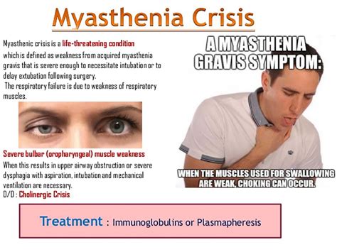 In addition, corticosteroids are reported to have certain direct neuromuscular actions. Surgery to remove the thymus gland in patients with ...