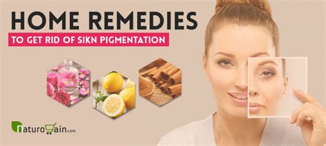 9 Home Remedies To Get Rid Of Skin Pigmentation Treat Naturally