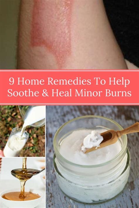 9 Home Remedies To Help Soothe And Heal Minor Burns Home And Gardening