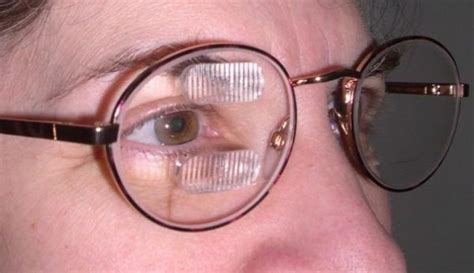 Prism Glasses Expand The View For Patients With Hemianopia Glasses Vision Glasses Anti Aging