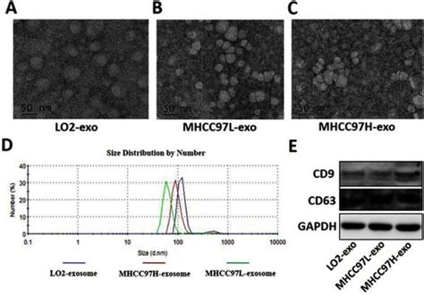 Full Article Exosomes Derived From HCC Cells With Different Invasion