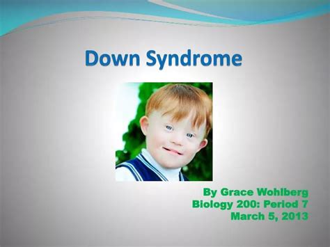 Ppt Down Syndrome Powerpoint Presentation Free Download Id2307614