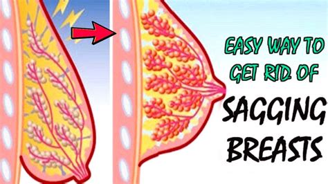 How To Prevent And Get Rid Of Sagging Breasts Naturally Youtube