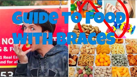 Guide To Food With Braces What Can You And Cant You Eat Youtube