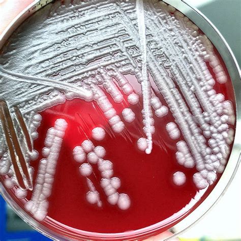 160 Bacillus Cereus Stock Photos Pictures And Royalty Free Images Istock