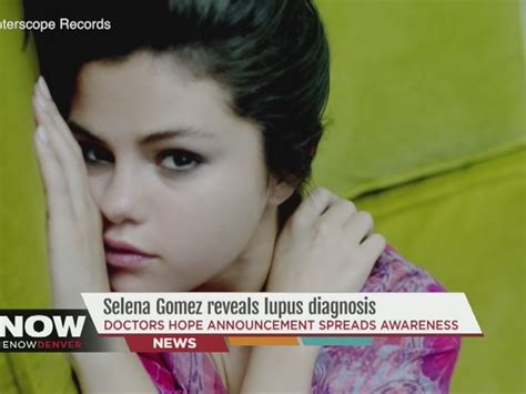 selena gomez reveals lupus diagnosis
