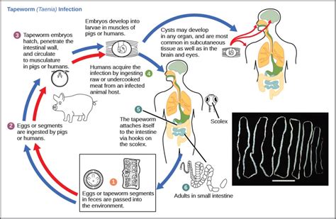 Taenia Solium Stepwards