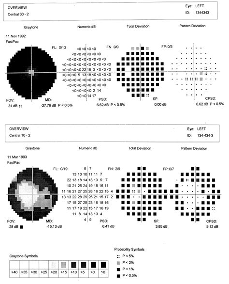 Progression Of Defects In The Central 10 Degree Visual Field Of