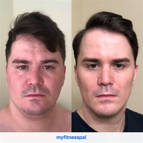 M2859” 211lbs158lbs53lbs Face Transformation After A Successful