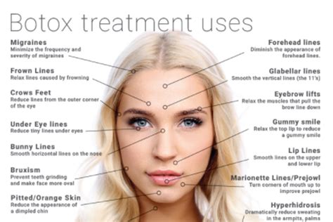 Botox Injection As Cosmetic Procedure Side Effects And Benefits