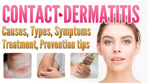 Contact Dermatitis Causes Types Symptoms Treatment Prevention Overseas Doctor