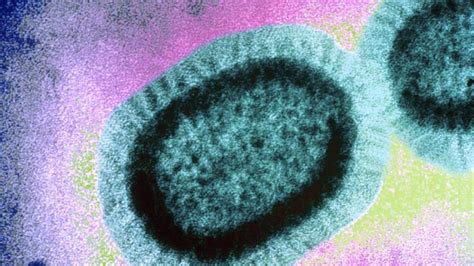 Influenza adalah infeksi saluran pernapasan yang disebabkan oleh virus influenza. Terkeren 10+ Gambar Kartun Sakit Flu Dan Batuk - Gani Gambar