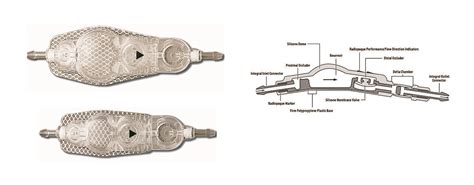 Medtronic Shunt Valve