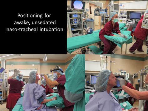 Positioning For Awake Sitting Nasotracheal Intubation Iowa Head And