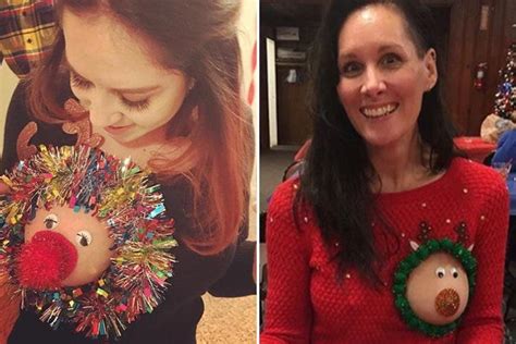 Reindeer Boobs Are Back As Daring Women Try Out The Titillating Festive Trend The Scottish Sun