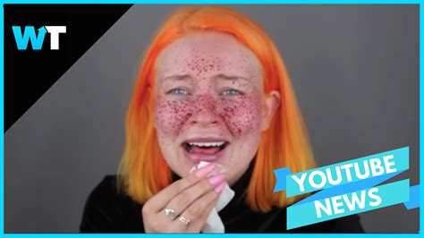 Video Permanent Freckle Beauty Fail Goes Viral Whats Trending