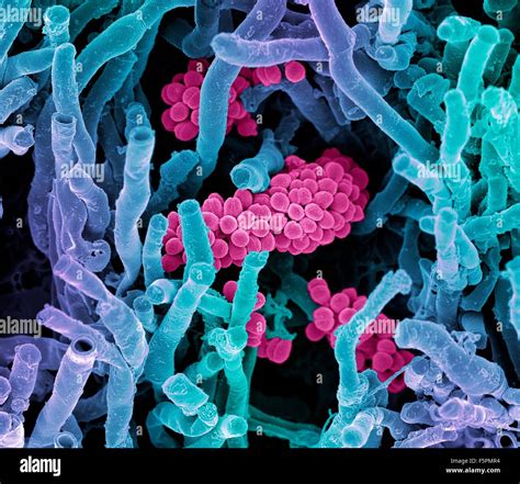 Streptomyces Coelicoflavus Bacterias Color Análisis Micrografía De