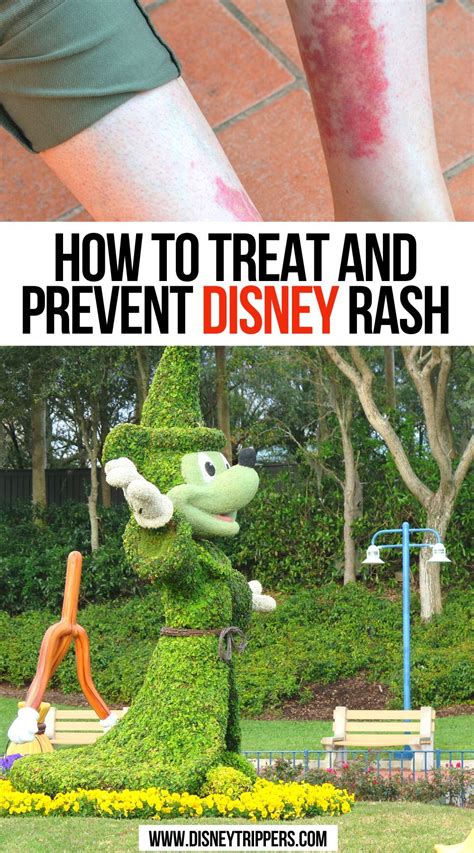How To Treat And Prevent Disney Rash Disney Travel Usa Travel America