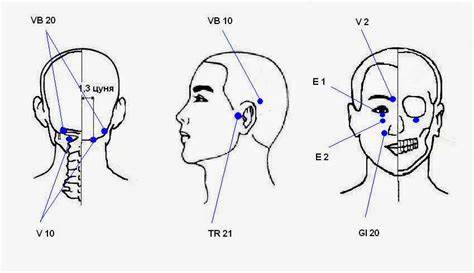 Диета при невралгии тройничного нерва Схема иглоукалывания при невралгии тройничного нерва - фото презентация Схема иглоукалывания при невралгии тройничного нерва - фото презентация Диета при невралгии тройничного нерва