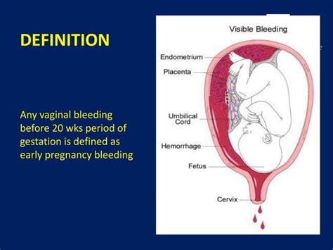Early Pregnancy Bleedingppt