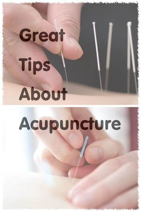 A Novices Guide To Getting Acupuncture Done Acupuncture How To Get How To Find Out