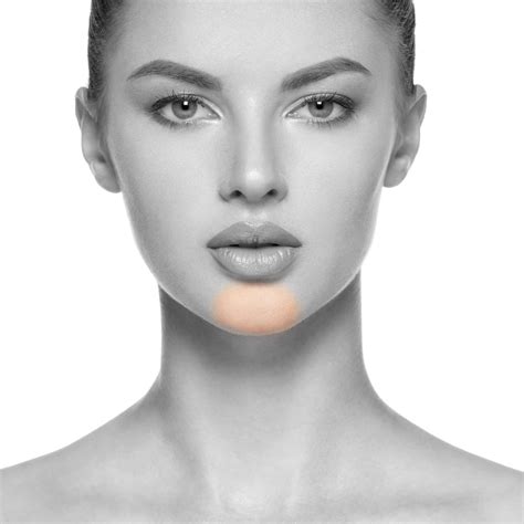 Chin Laser Hair Removal Nyc