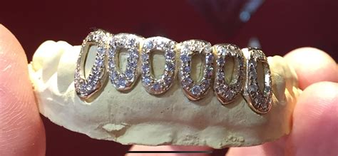 Check spelling or type a new query. Dimond Grillz - Gold Teeth Master