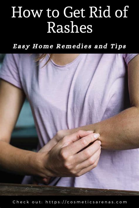 How To Get Rid Of Rashes Easy Home Remedies And Tips Home Remedies