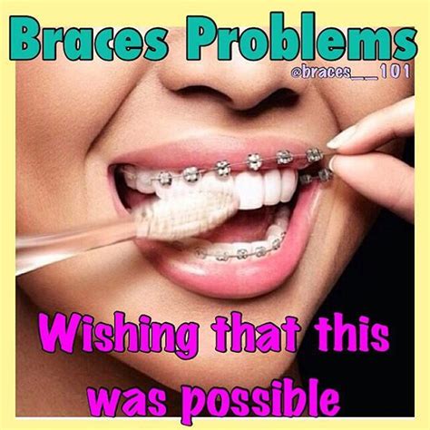 Yessss But I Ll Pull Them Off And Keep Them Off Braces Problems Dental Braces Braces Humor