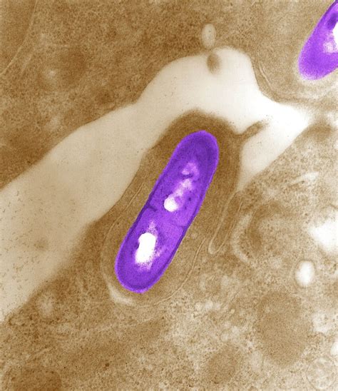 Image Libre Listeria Monocytogenes Infectieuse Lagent La
