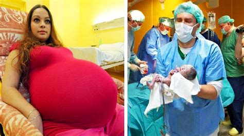 Mother Believes She Was Giving Birth To Twins Then The Docs Realize Her Rare Delivery Will Make