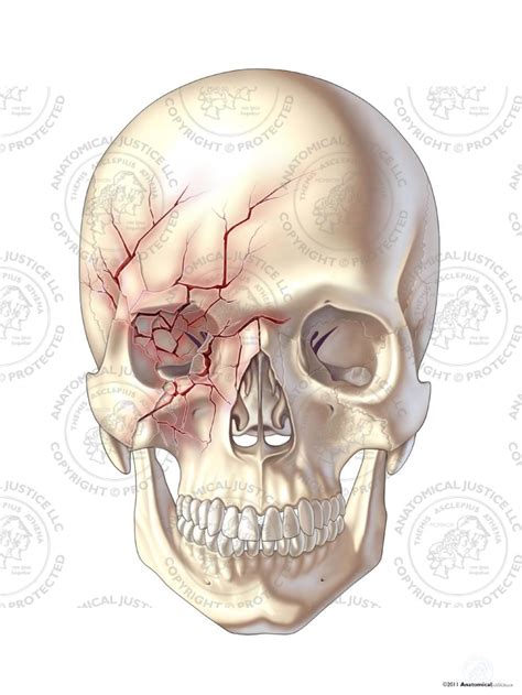 Anterior Right Skull Fractures No Text