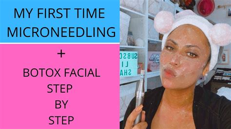 Cosmetic Microneedling Botox Facial Step By Step Youtube