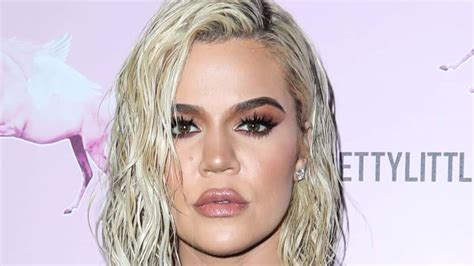 Khloe Kardashian Opens Up About Face Rumor And Why Shes Wearing Bandages