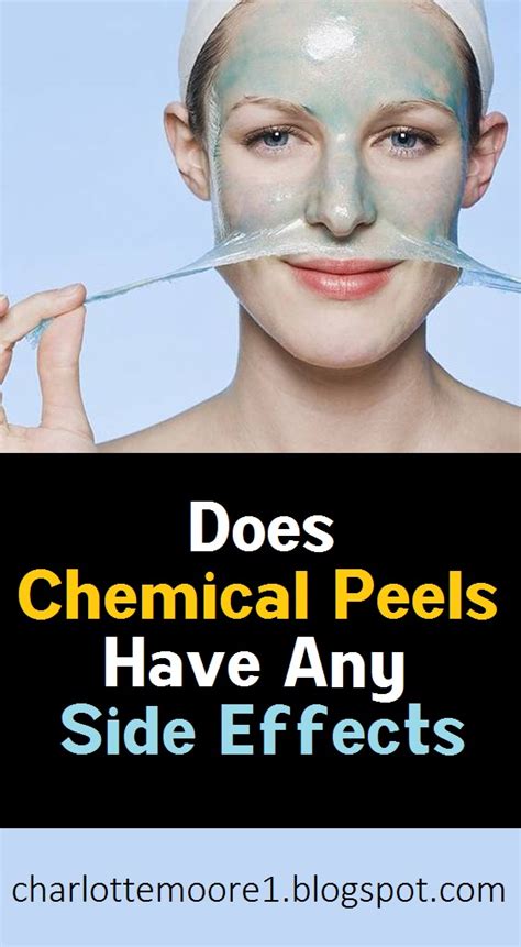 Does Chemical Peels Have Any Side Effects Charlotte Moore
