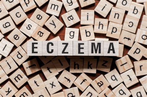 9 Early Signs Of Baby Eczema You Shouldnt Avoid