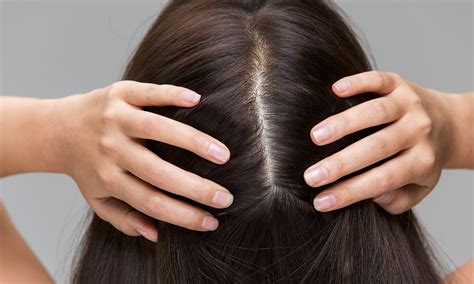 Best Treatments For A Healthy Scalp Focal Point Salon And Spa