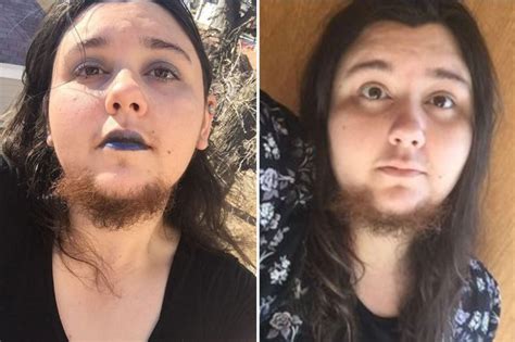 Woman 27 Refuses To Shave Her Hairy Beard Despite Getting Stares