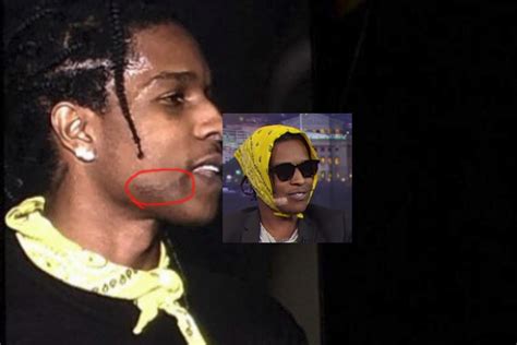 How Did Asap Rocky Hide That He Got His Face Sliced 2 Years Ago Ktt2