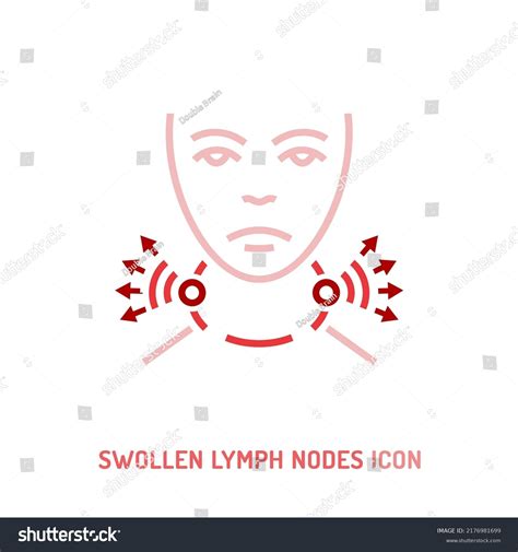 Swollen Lymph Nodes Icon Tonsils Pharyngitis Stock Vector Royalty Free