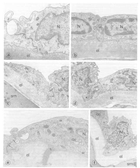 Comparison Of Ultrastructural Features Of Endothelial Cells Of Basilar