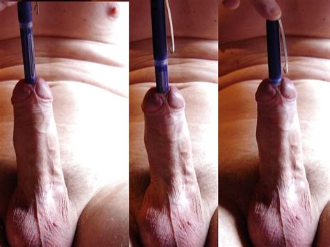 Bdsm Extreme Insertions Urethral Anal Femdom 109 Pics 2 Xhamster