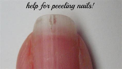 Peeling Nails Should You File Or Not To File Peeling Nails Treatment