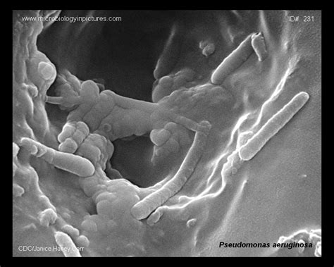 Pseudomonas Aeruginosa Sem Micrograph Appearance Of Pseudomonas