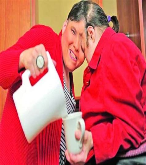 Check spelling or type a new query. 12 Insane Photos Of Conjoined Twins